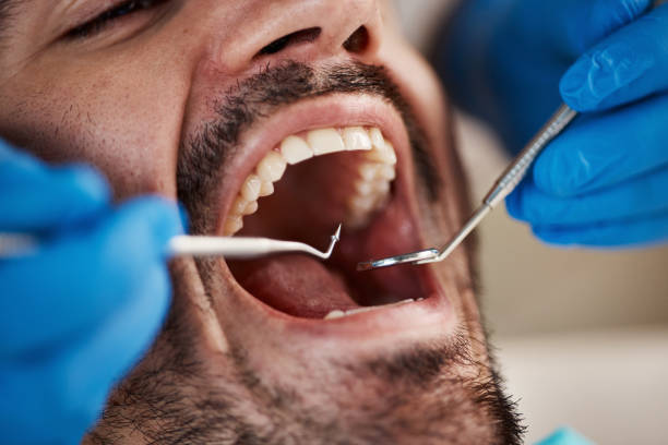 Best Broken or Chipped Tooth Repair in Galesburg, MI