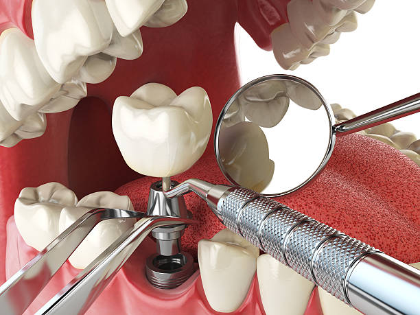 Best Dental Abscess Treatment in Galesburg, MI