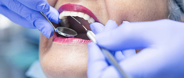 Best Emergency Dental Care for Sports Injuries in Galesburg, MI